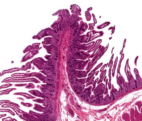 High-yield histology: the GI tract | Pathology Student