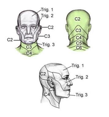 Dermatomas Cervicales Pdf