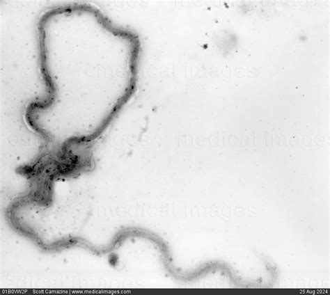 STOCK IMAGE, treponema pallidum shown under dark field light microscopy ...