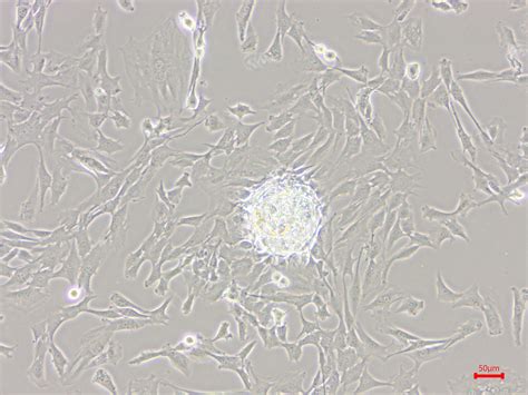 C2C12 Cell culture 중 궁금한 것이 생겨 질문드립니다! > BRIC