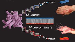 Comparing Leprosy Bacteria | The Scientist Magazine®