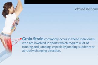 Groin Strain - Recovery, Treatment, Symptoms, Exercises, Prognosis