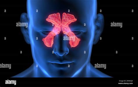 Inflamed sinuses, illustration Stock Photo - Alamy