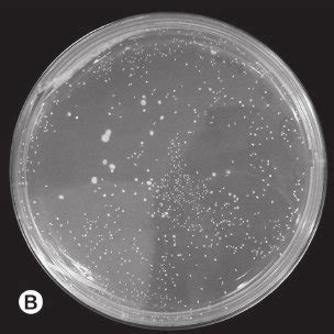 Comparison of Streptococcus sanguinis growth in the Control (A), Dye... | Download Scientific ...