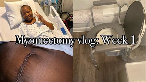 Myomectomy recovery: week 1 - YouTube