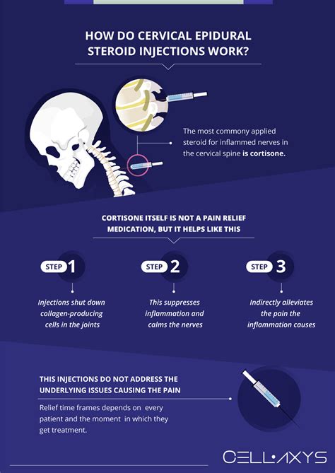 Cervical Epidural Steroid Injection: Success Rates And Risks - Cellaxys