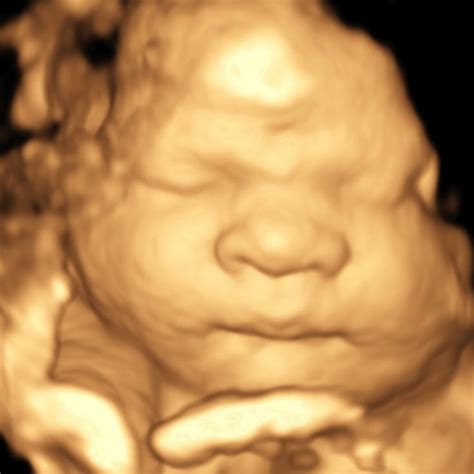 3D baby photo in the womb-so sweet! | Baby photos, Photo, Wonderful images