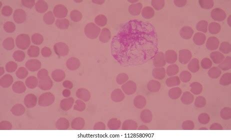 203 Red Blood Cells Flowing In Blood Vessel Stock Photos, Images & Photography | Shutterstock