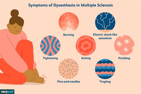 Dysesthesia in MS: Treatments and What It Feels Like