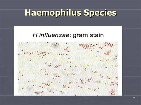 Haemophilus species