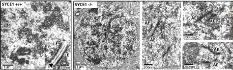 Electron Microscopy of the synaptonemal complex in wild-type and Syce1 ...