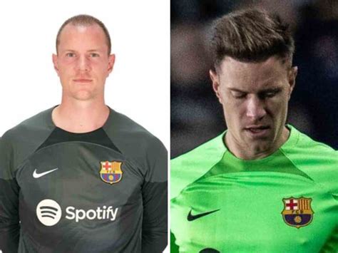 How Much Did It Cost Marc-Andre Ter Stegen To Get A Hair Transplant ...