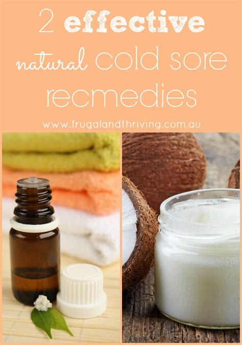 Two Highly Effective Natural Cold Sore Remedies To Try