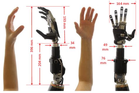 RIC prosthetic arm compared with the 25 th percentile female arm. | Download Scientific Diagram