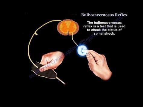 Dr. Nabil Ebraheim's Blogspot: Bulbocavernosus Reflex and Spinal Shock