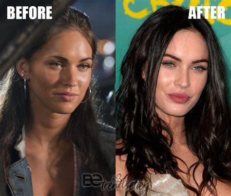 Megan Fox Plastic Surgery Before And After REVEALED!