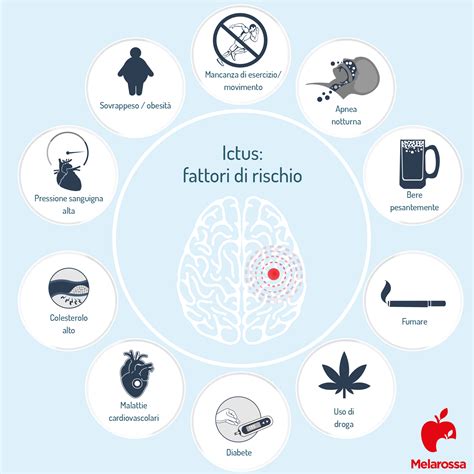 Ictus: cos'è, tipi, cause, sintomi, fattori di rischio, cure e prevenzione