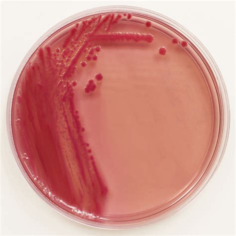 The Who’s Who of E. coli Strains – Microbiologics Blog