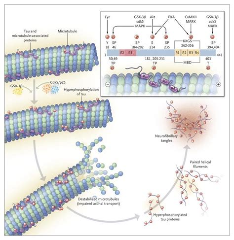 Tau protein and its role in neurodegenerative diseases. | Biology lessons, Biology lesson plans ...