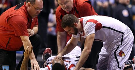 Louisville's Kevin Ware Has Surgery On Broken Leg - CBS Minnesota