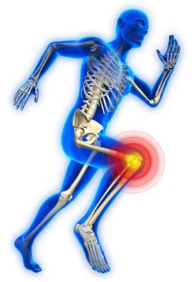 Sports Injury Chiropractor San Jose, CA | Sports Injury Doctor San Jose, CA | Physical Therapy ...