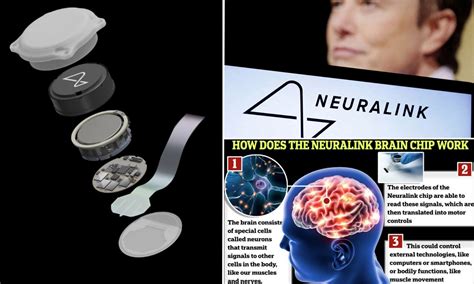 Elon Musk says first human patient implanted with a Neuralink brain-chip is moving a 'mouse ...