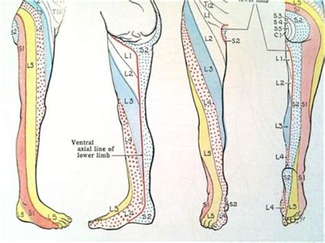 l3 and l4 nerves - Google Search | Sciatica, Chronic pain relief ...