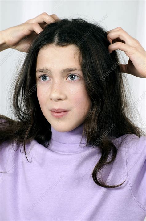 Girl with head lice - Stock Image - M825/0984 - Science Photo Library