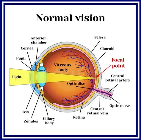 Normal Vision. Eyeball Structure. Medicine. Stock Vector - Illustration of disc, myopia: 80085760