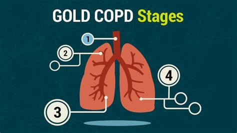 4 Stages Of Copd