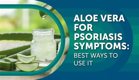 Aloe Vera for Psoriasis Symptoms: Best Ways To Use It | MyPsoriasisTeam