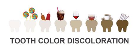 Tooth color discoloration