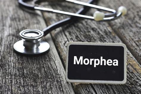 Signs, Causes, and Treatments of Morphea - Health & Detox & Vitamins