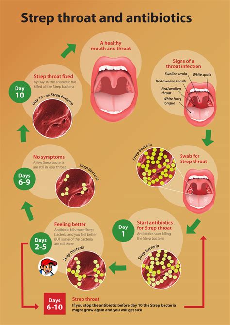 sore throat antibiotics