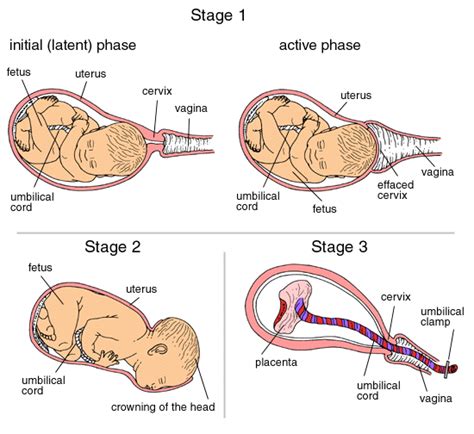 Phases And Stages Of Labor Chart