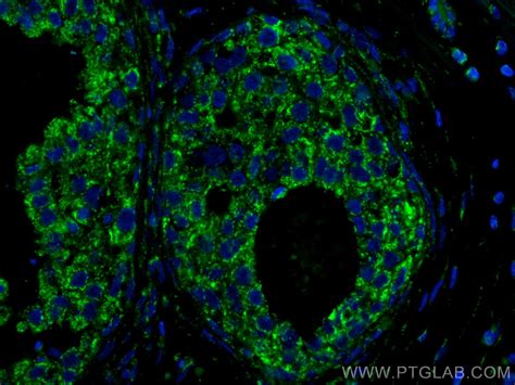 IL-4 antibody (66142-1-Ig) | Proteintech