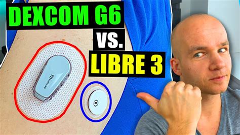 FreeStyle Libre 3 vs Dexcom G6 | Full Test & Review - YouTube