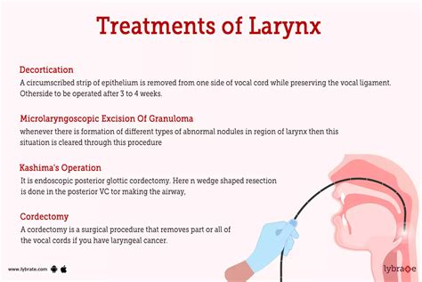 Larynx (Human Anatomy): Picture, Functions, Diseases, and Treatments