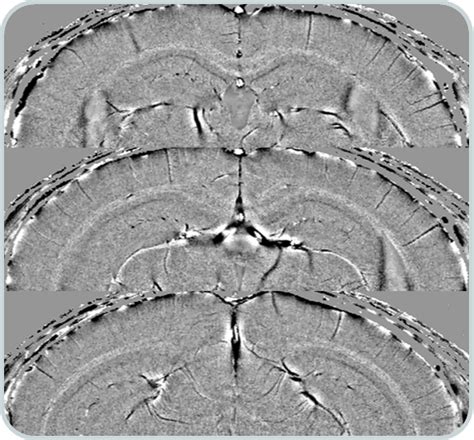 Mouse MRI CryoProbe | Bruker