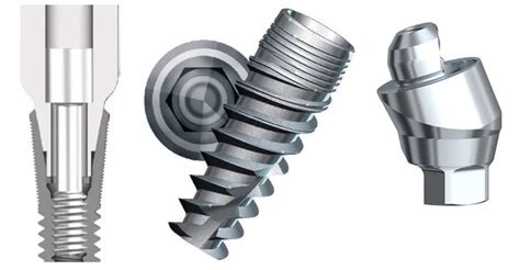 Comparison Of Implant/Abutment Connection Types