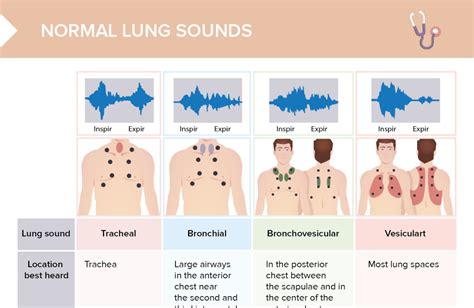 Charting Lung Sounds [+ Free Cheat Sheet] | Lecturio Nursing