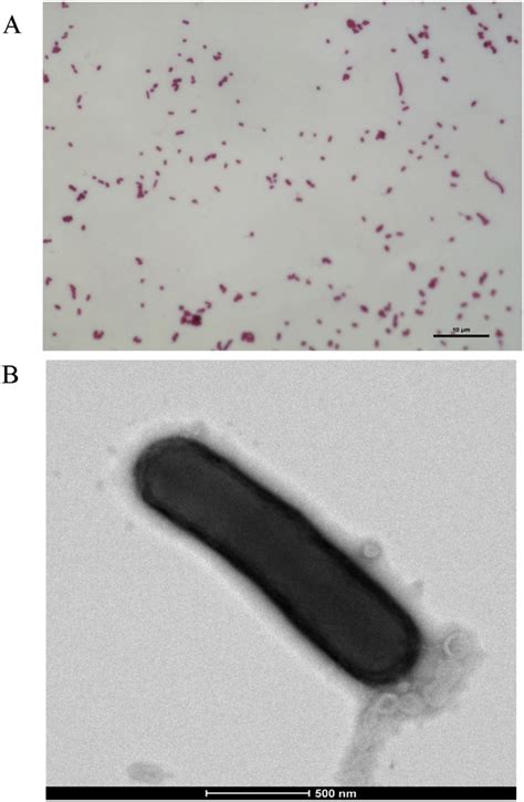 Microscopic aspects of Prevotella phocaeensis strain SN19 T . (A) Gram ...