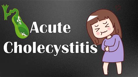 Acute Cholecystitis - Causes, Symptoms, Physical Signs, Diagnosis & Treatment - YouTube