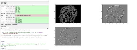 Edge Detection Opencv Laplacian Sobel And Canny Edge Detection - Mobile Legends