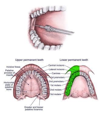 AZARSHAHRI DENTAL HYGIENE ANESTHESIA REVIEW