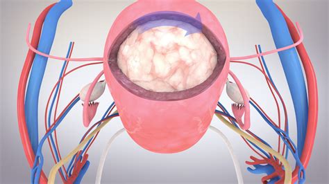 Laparoscopic Myomectomy Video - TVASurg - The Toronto Video Atlas of Surgery