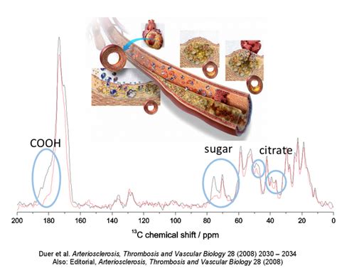 Vascular Calcification | Duer Research Group