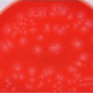 Colonies of Clostridium novyi on agar medium | Download Scientific Diagram