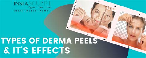 Types of derma Peels & its Effects on skin - Insta Sculpt