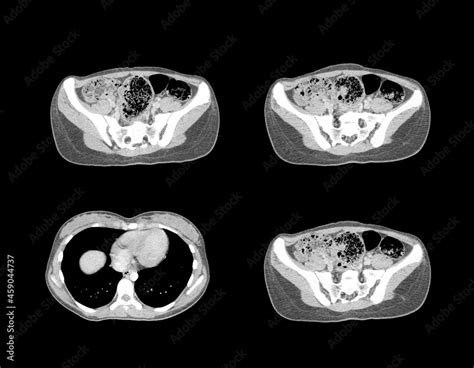 Abdomen ct scan and MRI professional images Stock Photo | Adobe Stock